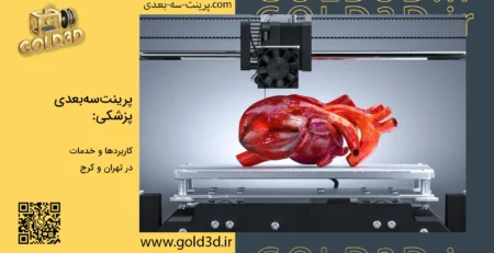 پرینت سه بعدی پزشکی