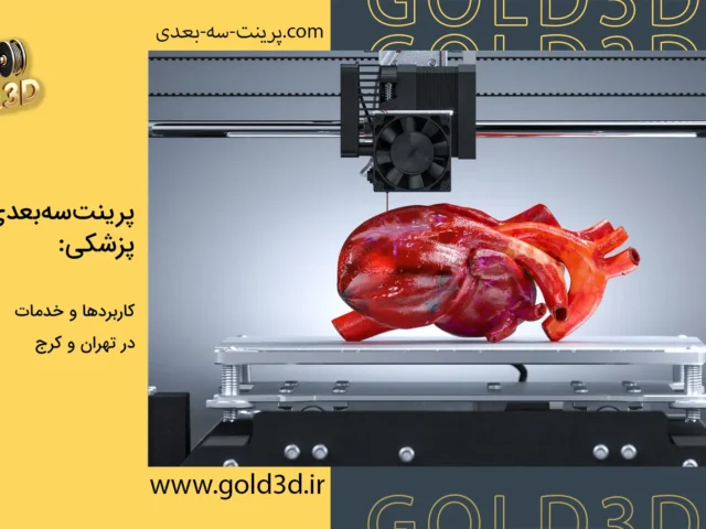 پرینت سه بعدی پزشکی