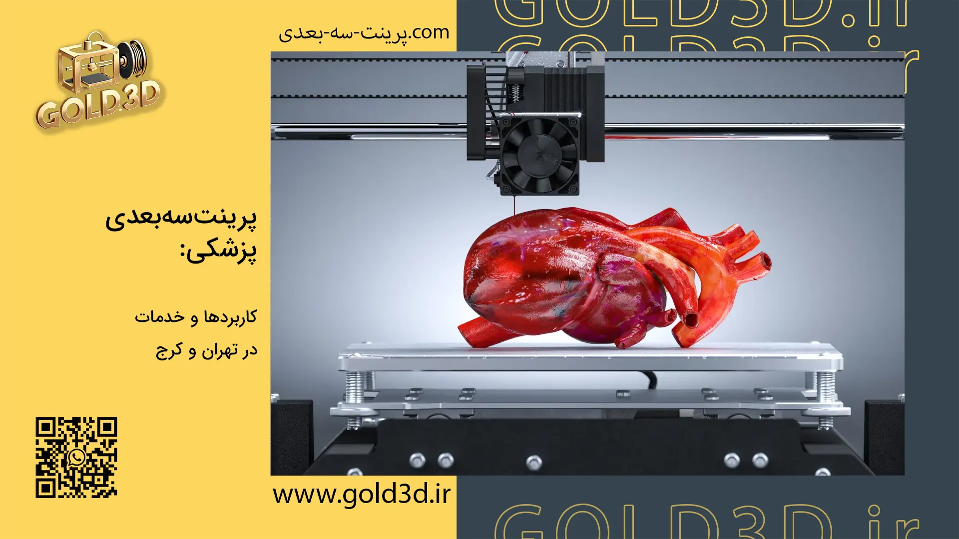 پرینت سه بعدی پزشکی